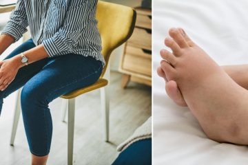 How to Prevent Feet Swelling While Sitting at Desk